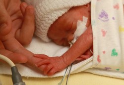 premature newborn holding mother's finger